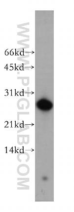 AK3 Antibody in Western Blot (WB)