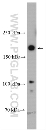 PBRM1 Antibody in Western Blot (WB)
