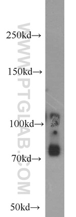 CD84 Antibody in Western Blot (WB)