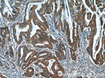 SMAD2 Antibody in Immunohistochemistry (Paraffin) (IHC (P))