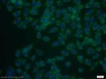 TSP50 Antibody in Immunocytochemistry (ICC/IF)