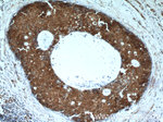 TSP50 Antibody in Immunohistochemistry (Paraffin) (IHC (P))