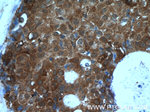 TSP50 Antibody in Immunohistochemistry (Paraffin) (IHC (P))