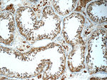 TSP50 Antibody in Immunohistochemistry (Paraffin) (IHC (P))