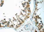 TSP50 Antibody in Immunohistochemistry (Paraffin) (IHC (P))