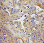 TSP50 Antibody in Immunohistochemistry (Paraffin) (IHC (P))