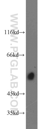 TSP50 Antibody in Western Blot (WB)