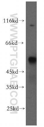 TSP50 Antibody in Western Blot (WB)
