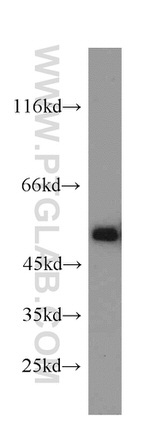 TSP50 Antibody in Western Blot (WB)