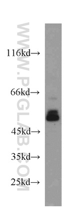 TSP50 Antibody in Western Blot (WB)