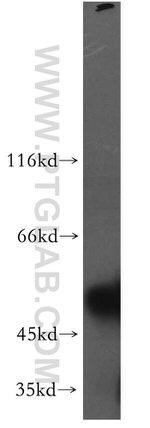 TSP50 Antibody in Western Blot (WB)