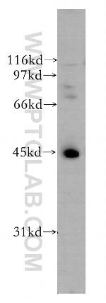 UBE2Q2 Antibody in Western Blot (WB)