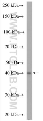 UBE2Q2 Antibody in Western Blot (WB)