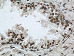 PTBP1 Antibody in Immunohistochemistry (Paraffin) (IHC (P))