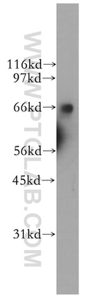 PTBP1 Antibody in Western Blot (WB)