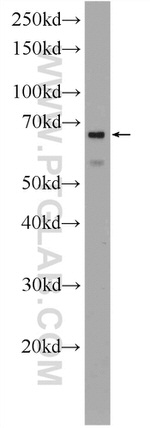 PTBP1 Antibody in Western Blot (WB)