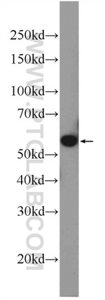 PTBP1 Antibody in Western Blot (WB)