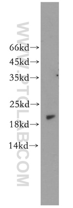 EXOSC1 Antibody in Western Blot (WB)