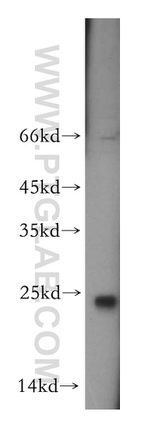 EXOSC1 Antibody in Western Blot (WB)