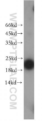 EXOSC1 Antibody in Western Blot (WB)