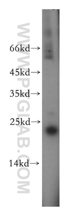 EXOSC1 Antibody in Western Blot (WB)