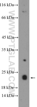 EXOSC1 Antibody in Western Blot (WB)
