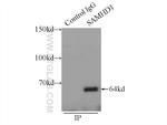 SAMHD1 Antibody in Immunoprecipitation (IP)