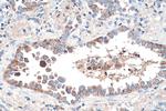 CRABP1 Antibody in Immunohistochemistry (Paraffin) (IHC (P))