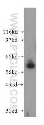 PPIL2 Antibody in Western Blot (WB)