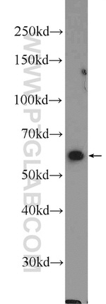 PPIL2 Antibody in Western Blot (WB)