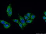 FDX1 Antibody in Immunocytochemistry (ICC/IF)