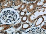 FDX1 Antibody in Immunohistochemistry (Paraffin) (IHC (P))
