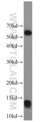 FDX1 Antibody in Western Blot (WB)