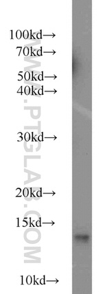 FDX1 Antibody in Western Blot (WB)