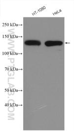 Integrin beta-1 Antibody in Western Blot (WB)
