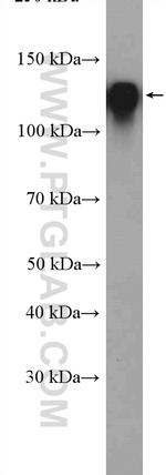Integrin beta-1 Antibody in Western Blot (WB)