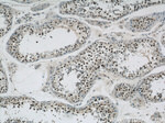 GABPB1 Antibody in Immunohistochemistry (Paraffin) (IHC (P))