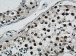 GABPB1 Antibody in Immunohistochemistry (Paraffin) (IHC (P))
