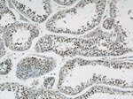 GABPB1 Antibody in Immunohistochemistry (Paraffin) (IHC (P))