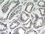 GABPB1 Antibody in Immunohistochemistry (Paraffin) (IHC (P))