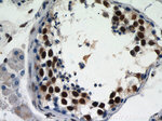 GABPB1 Antibody in Immunohistochemistry (Paraffin) (IHC (P))