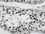 GABPB1 Antibody in Immunohistochemistry (Paraffin) (IHC (P))