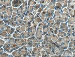 CPB1 Antibody in Immunohistochemistry (Paraffin) (IHC (P))