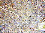 CPB1 Antibody in Immunohistochemistry (Paraffin) (IHC (P))