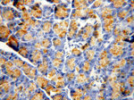 CPB1 Antibody in Immunohistochemistry (Paraffin) (IHC (P))