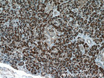 CPB1 Antibody in Immunohistochemistry (Paraffin) (IHC (P))