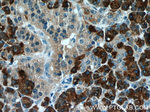 CPB1 Antibody in Immunohistochemistry (Paraffin) (IHC (P))