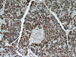 CPB1 Antibody in Immunohistochemistry (Paraffin) (IHC (P))