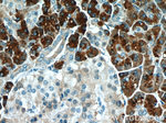 CPB1 Antibody in Immunohistochemistry (Paraffin) (IHC (P))