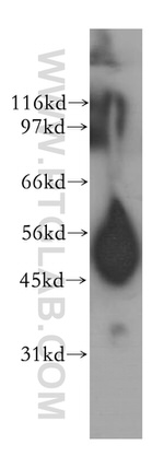 CPB1 Antibody in Western Blot (WB)